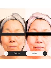 ゆう/ビフォーアフター