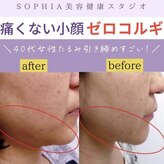 ソフィア(SOPHIA)