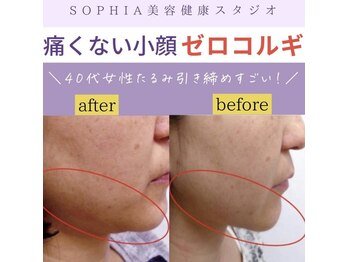 ソフィア(SOPHIA)