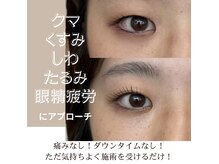 ショコラッシュ(Shocolash)の雰囲気（中国地方で唯一受けれるアイパワーエステ！［たるみ/シワ/クマ]）