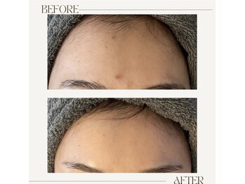 アンド(&.)/before/after