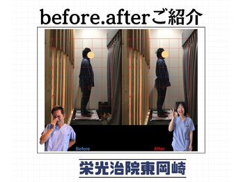 栄光治院 整体院東岡崎/岡崎/整体/腰痛/肩こり/猫背矯正