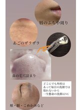 グレイス(Grace)/