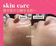 サンカリビューティー(SANKARI beauty)