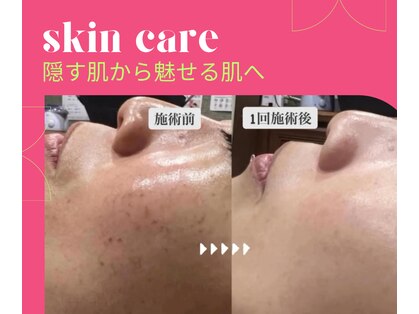サンカリビューティー(SANKARI beauty)の写真