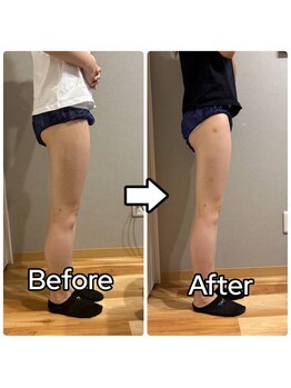 美波整体院 矢巾院/フォースカッターbefore→after