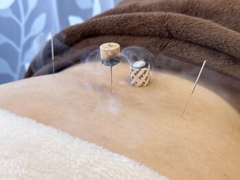 命水鍼灸院/腰痛【新宿/鍼灸】