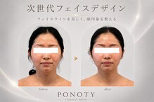 ポノティー(PONOTY)