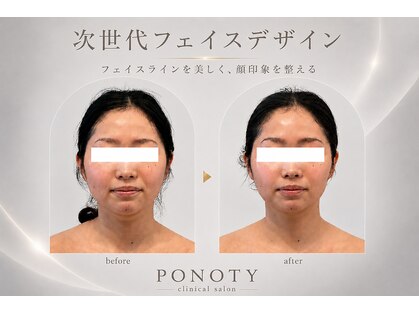 ポノティー(PONOTY)の写真