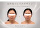ポノティー(PONOTY)の写真