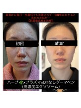 独自の【新型メソッド】全く新しい技法で圧倒的効果と定着率を★美容通や女性芸能人もお忍びで通う話題沸騰