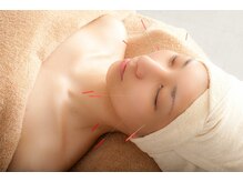 ハリリーナ(Haririna)/鍼灸の即効性×エステの持続力