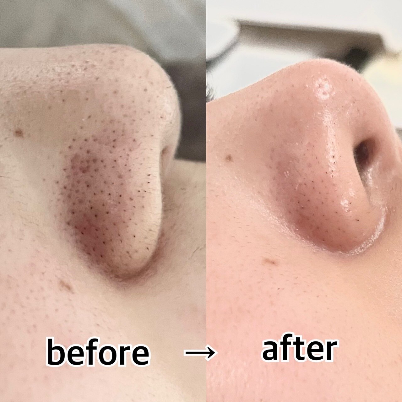 アンジェ(Ange)｜ホットペッパービューティー