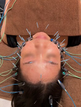 仁接骨院 じん鍼灸治療院の写真/【いくつになっても綺麗でい続けたい方へ】資格を持つベテランオーナーがあなたのお肌悩みに寄り添います！