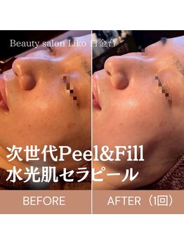 リコ 白金台(Liko)/