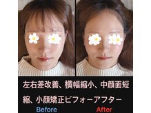 美容矯正サロン レレポノ(LELEPONO)/