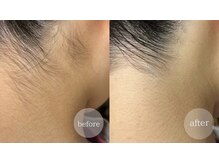 アンドエピ(&epi)/