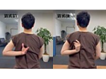 リカバリーサロンタップ(Recovery salon TAP)/肩の痛みがある方のbefore/after