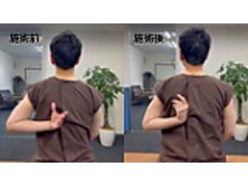 リカバリーサロンタップ(Recovery salon TAP)/肩の痛みがある方のbefore/after