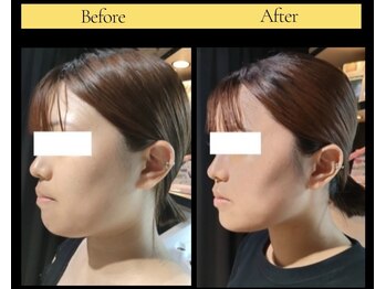 カーム(Calm)/レモンボトル