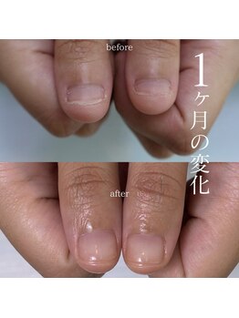 スイ(sui.)の写真/自爪育成をしながらネイルを楽しむ☆育成方法3種類からあなたに合う施術をご提案！健康的な美しい指先へ