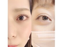 ビューティーバイツリー(Beauty by TRYY)の雰囲気（話題のLashliftとアイブロウデザインで完璧な目元を目指せる☆）