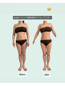 クレーアインス(kleeins)/＊winback＋ハンド施術　＊