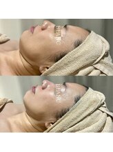 サロン ド ブラン アオヤマ(Salon de BLANC AOYAMA)/美白ケア&小顔ケア