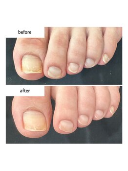 ネイルアトリエ ボン(nail atelier bon)/フットネイルケア