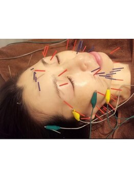 鍼灸施術を受けたい