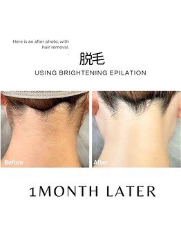 ハグミー 甲子園口(HUGME.)/うなじ美人★