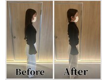 整体ラルース 中目黒(LALUZ)/30代 女性　猫背、巻き肩改善