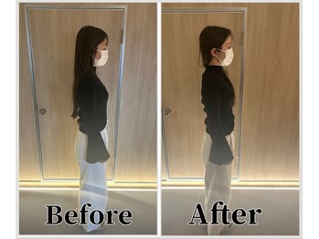 整体ラルース 中目黒(LALUZ)/30代 女性 猫背、巻き肩改善