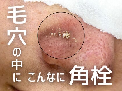 シュリ(Shri)の写真