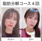 リジュベネ(rejuvena)