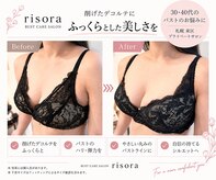 リソラ(risora)