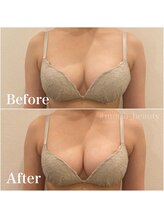 モット 神戸店(Motto)/光豊胸