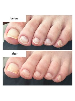 ネイルアトリエ ボン(nail atelier bon)/フットネイルケア