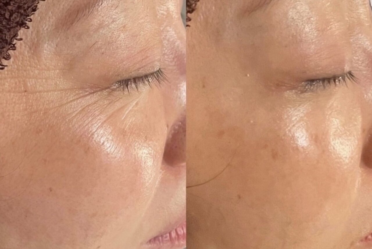 クーポン・メニュー｜モテスリム｜ホットペッパービューティー