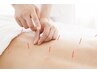2回目の方限定【慢性腰痛/股関節・膝の不調】スポーツマッサージ＋鍼灸 90分