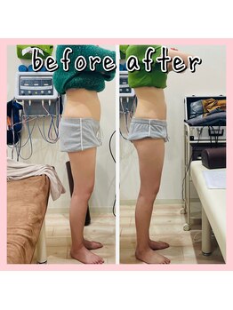 昭和区川名ひまわり接骨院/産後骨盤矯正×ダイエット【6】