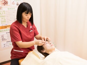 三越前はり灸整骨院/頭痛による鍼施術
