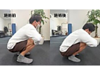 リカバリーサロンタップ(Recovery salon TAP)/膝の裏が痛む方のbefore/after