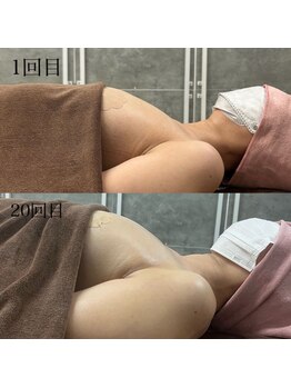 ブレスト サロン 奈良店(Bryst Salon)の写真/憧れのバストラインへ!どんなお悩みにもアプローチ◎ハリとボリュームアップをサポート◎