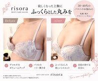 リソラ(risora)