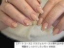 ストーンフレンチ#パラジェル