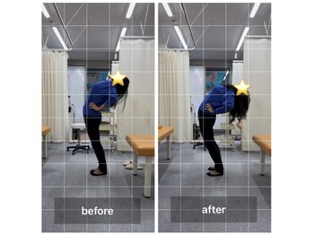 ナオル整体 飯田橋院(NAORU整体)/Before After/飯田橋/整体・矯正