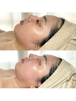 サロン ド ブラン アオヤマ(Salon de BLANC AOYAMA)/BIOPHYTO×Sonocare