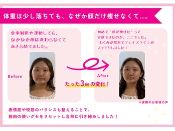 理想の小顔 福島店/まず3ヶ月施術を続ける事が近道