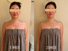 カオン(kaon)/ブライダルエステ3回のお客様